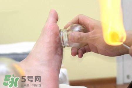 冬天拔火罐能減肥嗎？拔火罐什么季節減肥效果最好？