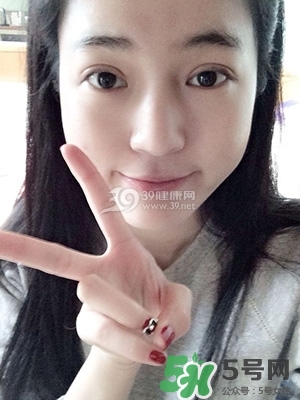 什么是定點雙眼皮？定點雙眼皮多少錢？