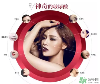 喬雅登是哪個國家的？喬雅登玻尿酸哪個國家？