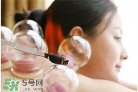 拔罐放血要注意什么？拔罐放血的注意事項(xiàng)