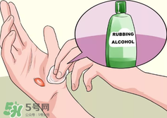 水泡怎么處理？水泡要不要刺破？
