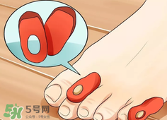 水泡怎么處理？水泡要不要刺破？