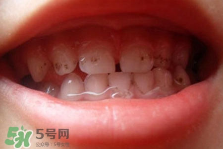 刷牙后吃東西發(fā)苦正常嗎？為什么刷牙后吃東西發(fā)苦？