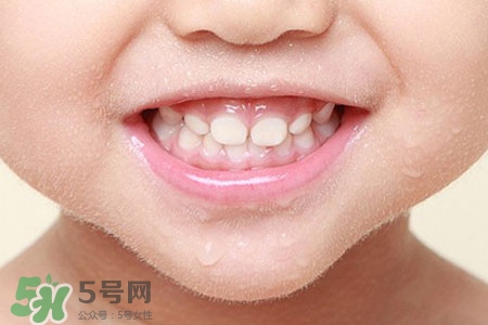 刷牙后吃東西發(fā)苦正常嗎？為什么刷牙后吃東西發(fā)苦？