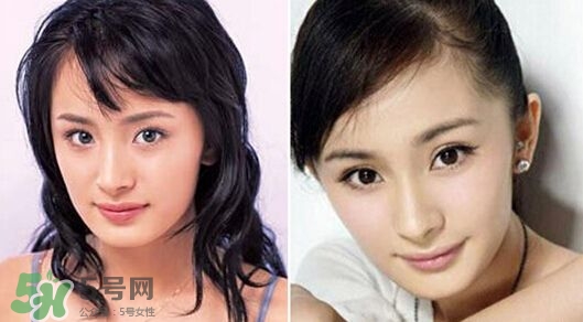 打瘦臉針能懷孕嗎？打瘦臉針能吃避孕藥嗎？