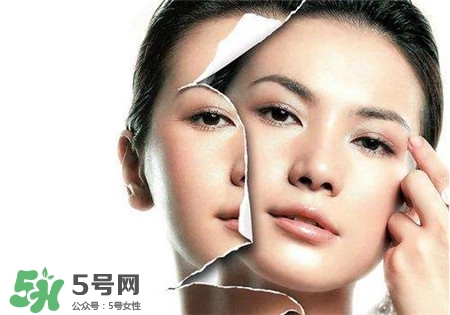 美白針是什么？美白針可以連續打嗎？