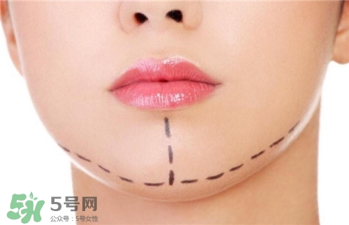 玻尿酸墊下巴能維持多久？玻尿酸墊下巴能維持多長時間？