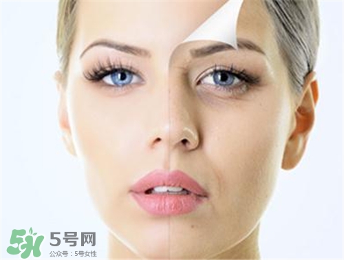 玻尿酸除皺有效果嗎？玻尿酸除皺效果怎么樣？