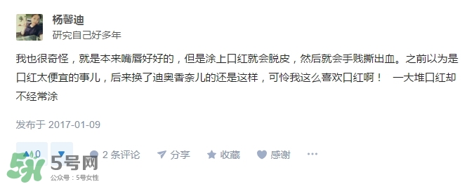 涂口紅會脫皮嗎？涂口紅為什么會脫皮？