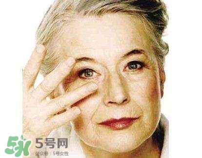 老年斑是怎么形成的？老年斑的形成原因