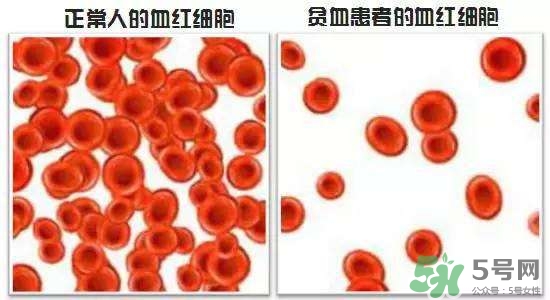 缺鐵性貧血的癥狀 缺鐵性貧血的癥狀有哪些？