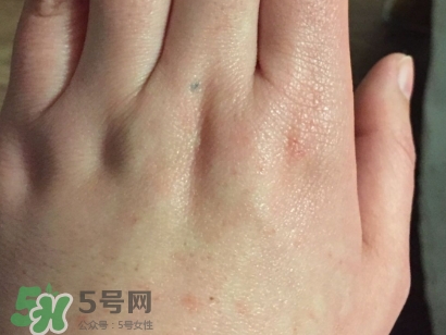 薇諾娜適合什么皮膚？薇諾娜適合敏感肌嗎？