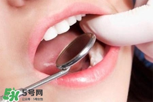 口腔異味是怎么回事？口腔異味怎么清除？