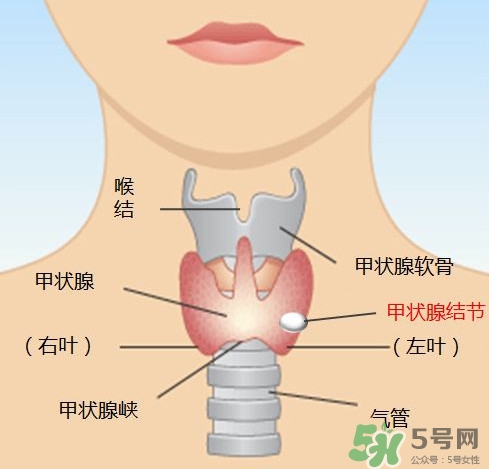 甲狀腺結節如何治療 甲狀腺結節的癥狀