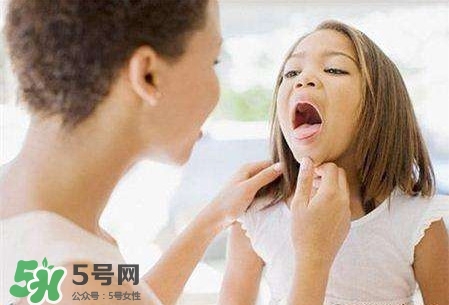 吃魚(yú)卡刺窒息死亡 喉嚨卡刺怎么辦小竅門(mén)