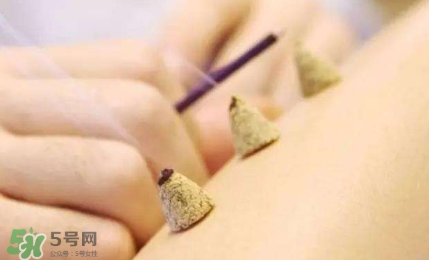 剛懷孕可以艾灸嗎？剛懷孕可以艾灸腹部嗎
