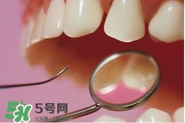 牙周炎傳染嗎？牙周炎會不會傳染