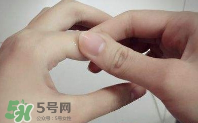 痛風有什么癥狀？女性痛風的初期癥狀