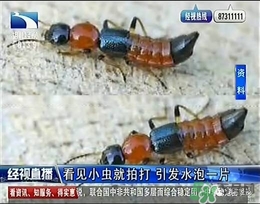 隱翅蟲有毒嗎？隱翅蟲會毀容嗎？