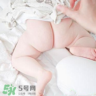 尿布疹和濕疹的區別 尿布疹和濕疹如何區分？