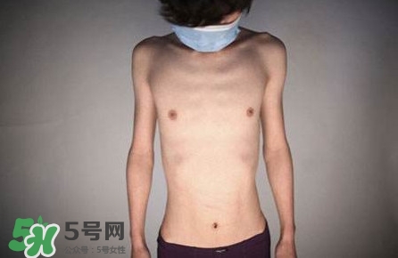 HIV真有這么可怕嗎？艾滋病的臨床表現主要有哪些