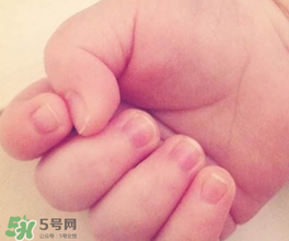 寶寶指甲凹凸不平是什么原因？寶寶指甲凹凸不平正常嗎？