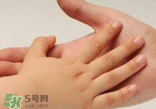 寶寶指甲凹凸不平是什么原因？寶寶指甲凹凸不平正常嗎？