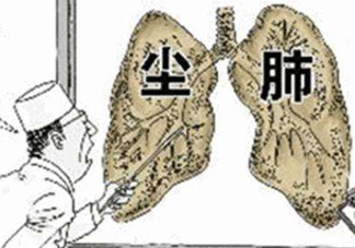 塵肺病能治愈嗎？塵肺病能活多久