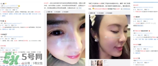 天倍面膜是日本的嗎？日本tenbe天倍面膜騙局
