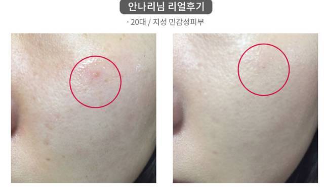 real skin patch怎么樣？real skin是什么牌子