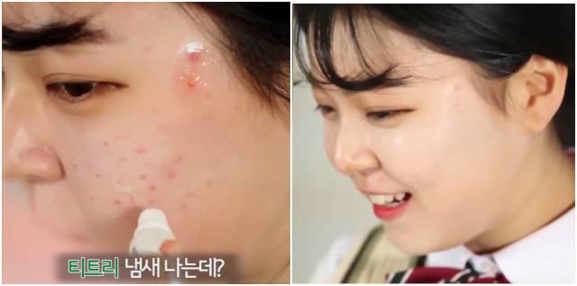 real skin patch怎么樣？real skin是什么牌子
