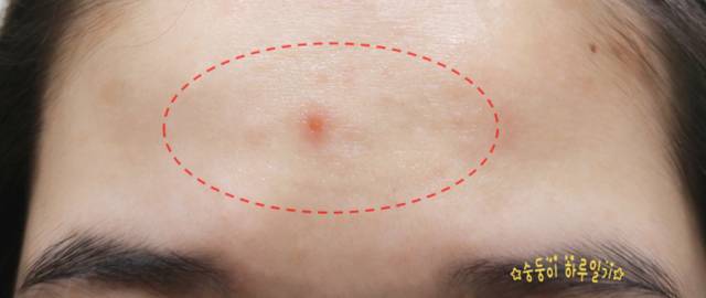 real skin patch怎么樣？real skin是什么牌子