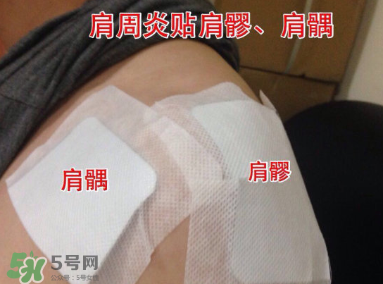 艾灸貼多少錢一盒?？艾灸貼一盒60裝多少錢？