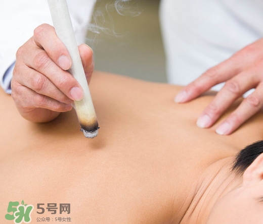 三伏貼和艾灸哪個好？三伏貼和艾灸區別