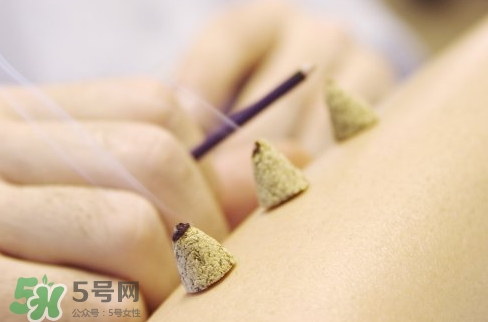 三伏貼和艾灸哪個好？三伏貼和艾灸區別