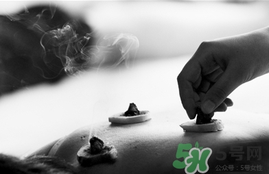 三伏灸什么時(shí)候開始灸？三伏灸怎么灸？