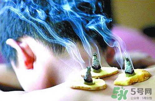 三伏灸什么時(shí)候開始灸？三伏灸怎么灸？