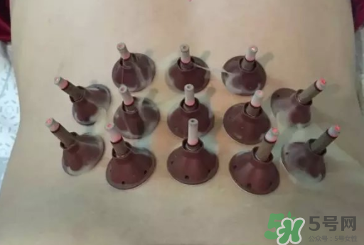 艾艾貼可以貼肚臍眼嗎？艾艾貼貼肚臍有什么作用？