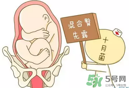 胎位不正能順產嗎？胎位不正怎么辦？