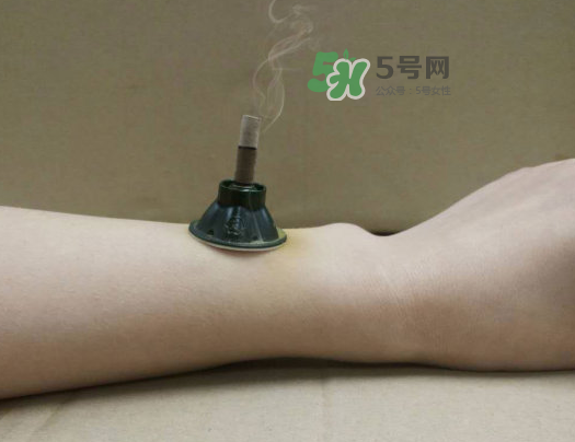 三伏天下雨可以艾灸嗎？三伏天下雨艾灸好嗎？