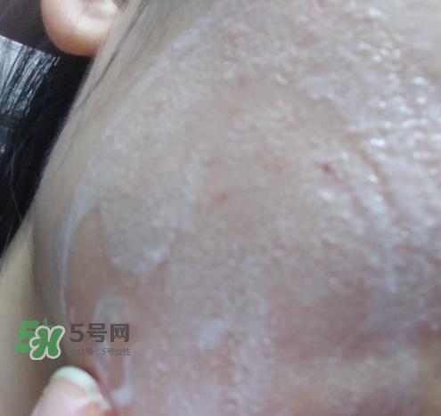 貝蜜清凈痘控油潔面啫喱怎么樣？貝蜜清祛痘控油潔面啫喱好用嗎？