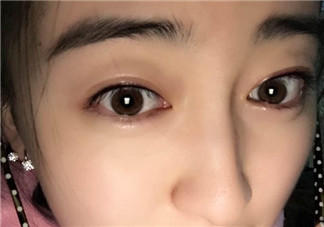 做美瞳線會不會掉睫毛？做美瞳線掉睫毛怎么辦？