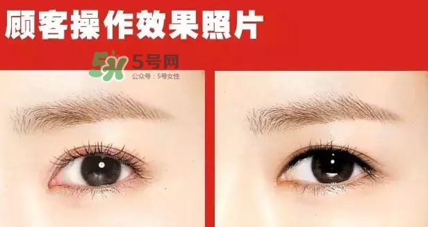 美瞳線有必要做嗎？做美瞳線多少錢？