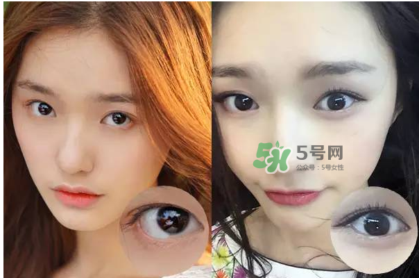 做美瞳線會(huì)不會(huì)掉睫毛？做美瞳線掉睫毛怎么辦？
