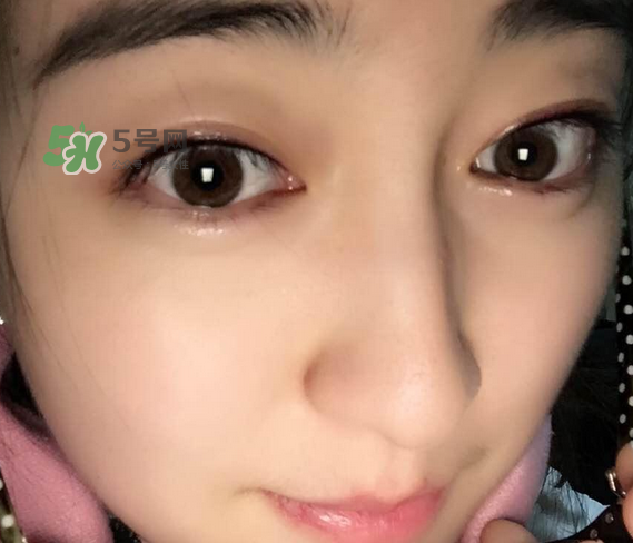 做美瞳線可以喝酒嗎？做美瞳線喝酒有影響嗎？