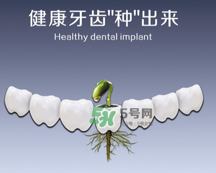 種植牙費用多少錢？國產種植牙價格