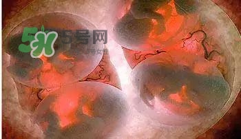 多胞胎是怎么生產的？多胞胎應選擇什么分娩方式