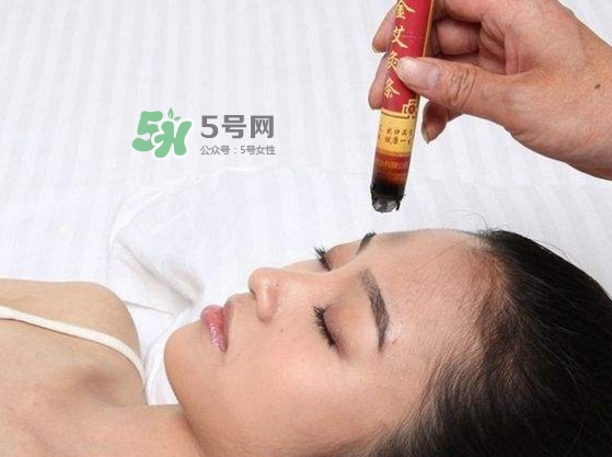 艾灸會不會過敏？艾灸過敏怎么辦