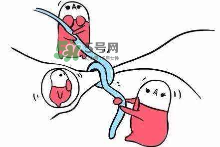 結(jié)扎好還是上環(huán)好？結(jié)扎上環(huán)哪個危害小？