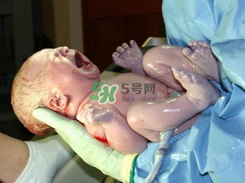 順產有多疼？順產的疼痛可以忍受嗎？